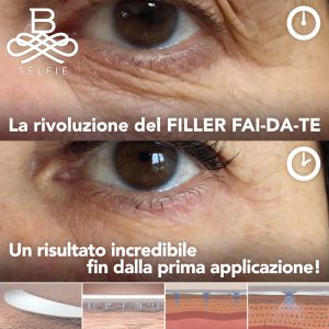 post_prima-dopo